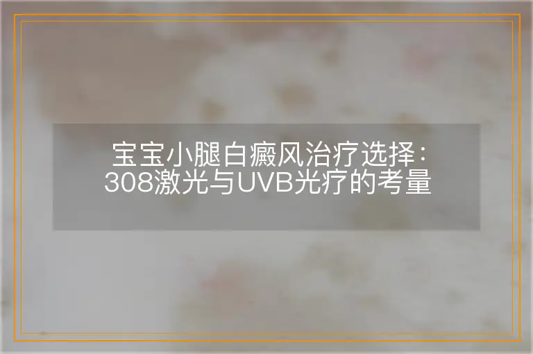 宝宝小腿白癜风治疗选择：308激光与UVB光疗的考量