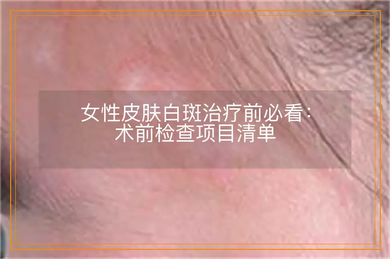 女性皮肤白斑治疗前必看:术前检查项目清单