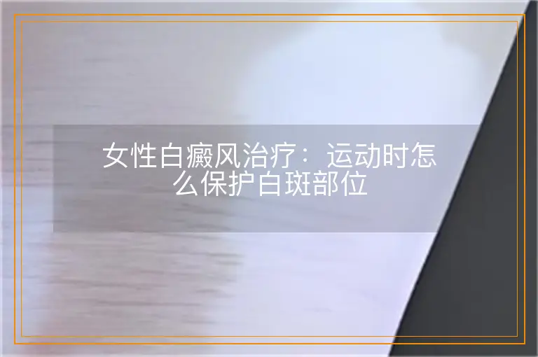 女性白癜风治疗:运动时怎么保护白斑部位