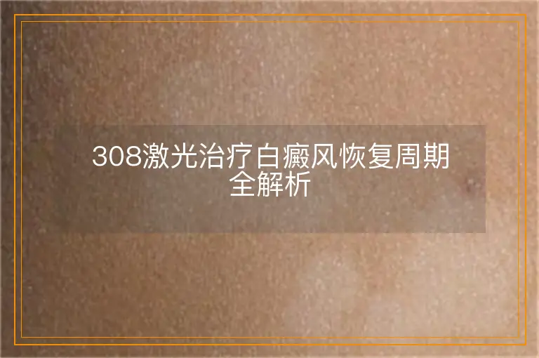 308激光治疗白癜风恢复周期全解析