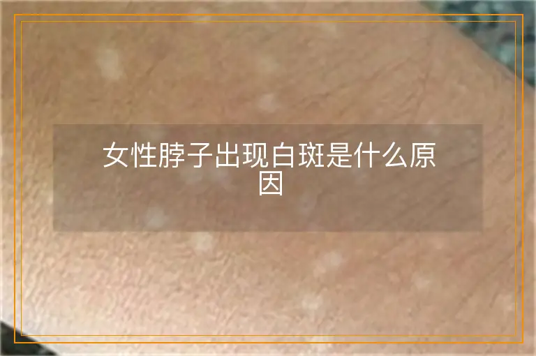 女性脖子出现白斑是什么原因