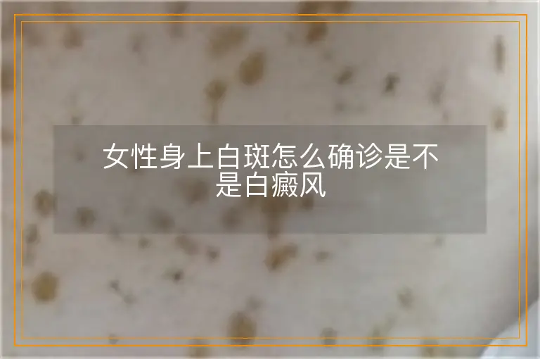 女性身上白斑怎么确诊是不是白癜风
