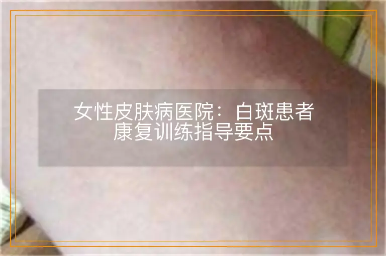 女性皮肤病医院:白斑患者康复训练指导要点
