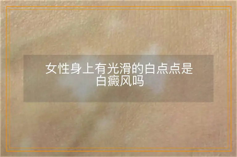 女性身上有光滑的白点点是白癜风吗
