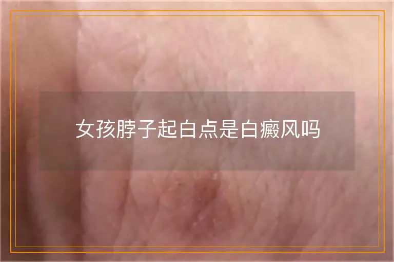 女孩脖子起白点是白癜风吗