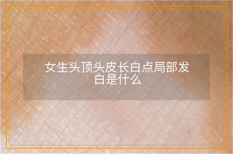 女生头顶头皮长白点局部发白是什么