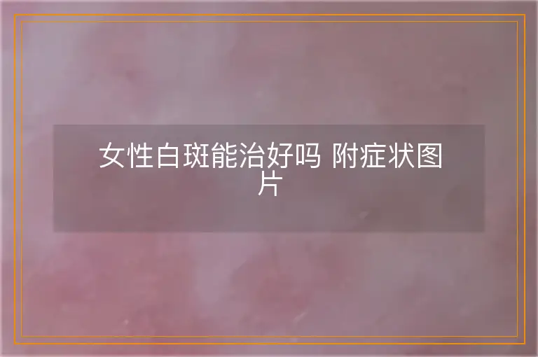 女性白斑能治好吗 附症状图片