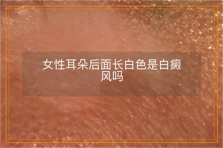 女性耳朵后面长白色是白癜风吗