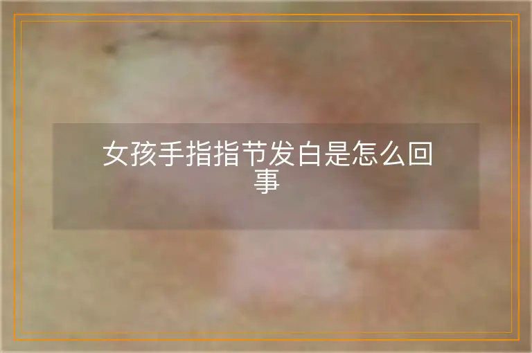 女孩手指指节发白是怎么回事