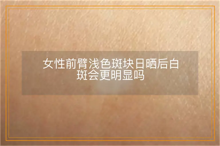 女性前臂浅色斑块日晒后白斑会更明显吗