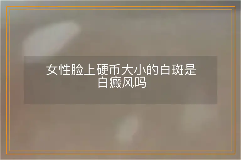 女性脸上硬币大小的白斑是白癜风吗