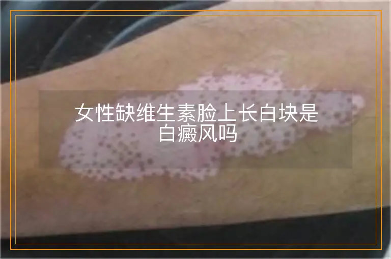 女性缺维生素脸上长白块是白癜风吗