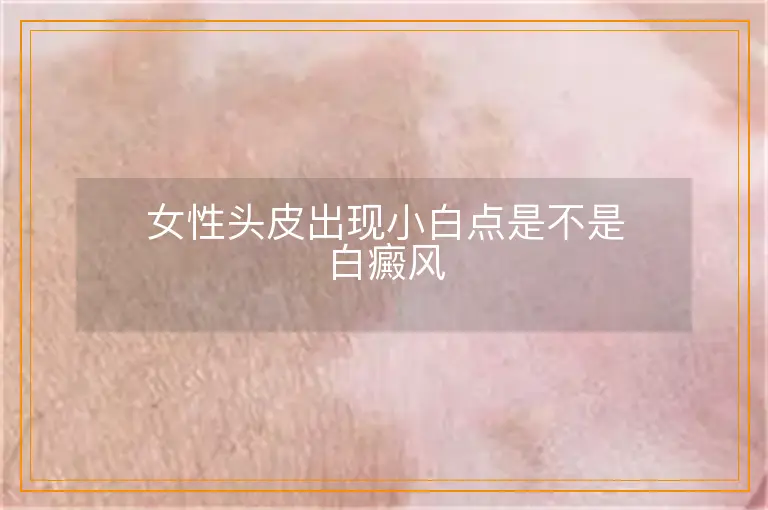 女性头皮出现小白点是不是白癜风