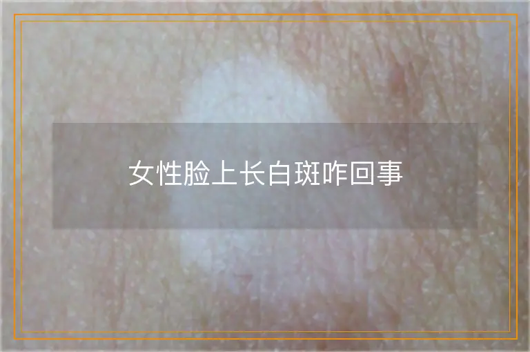 女性脸上长白斑咋回事