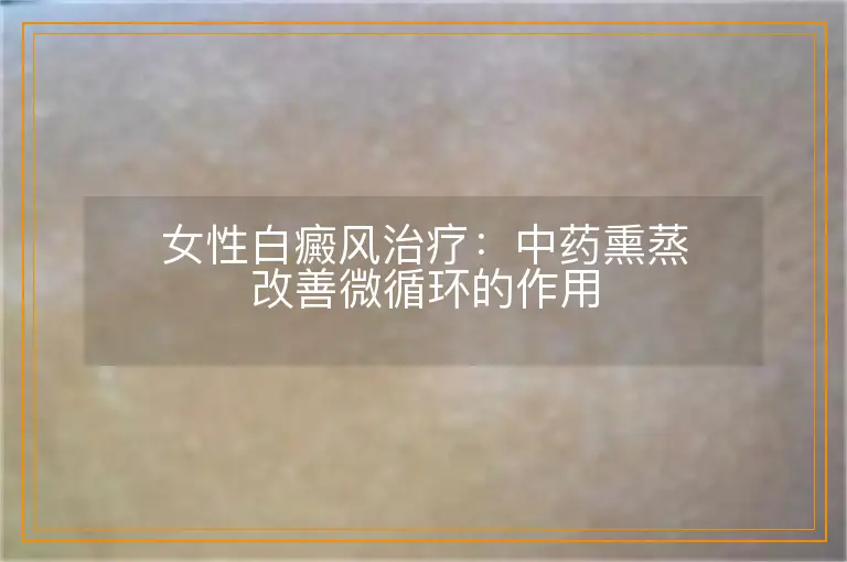 女性白癜风治疗:中药熏蒸改善微循环的作用