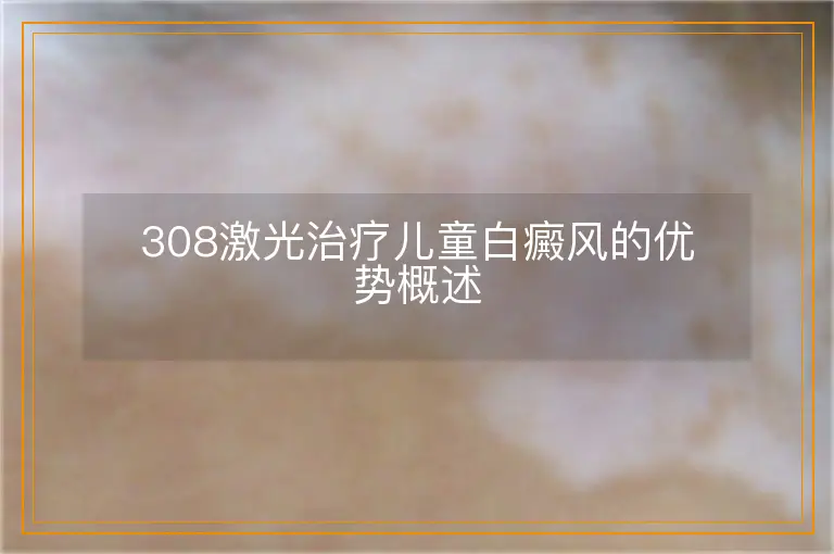 308激光治疗儿童白癜风的优势概述