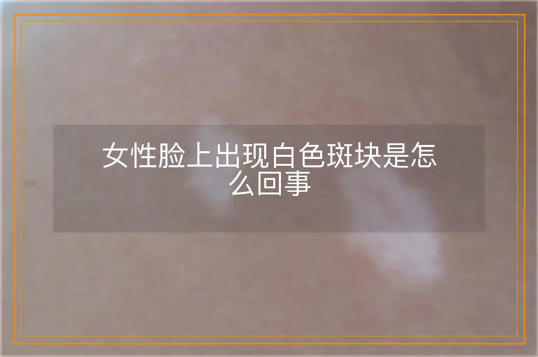 女性脸上出现白色斑块是怎么回事