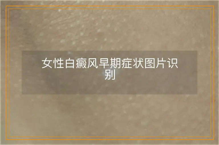 女性白癜风早期症状图片识别