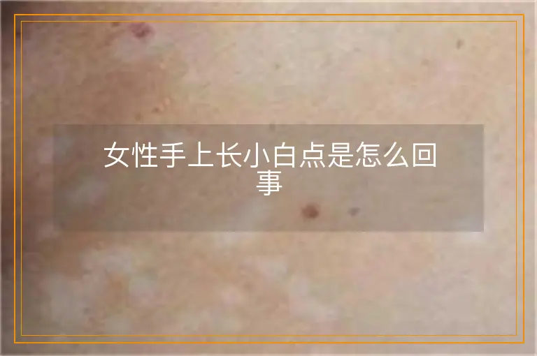 女性手上长小白点是怎么回事
