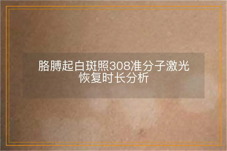 胳膊起白斑照308准分子激光恢复时长分析