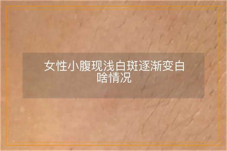 女性小腹现浅白斑逐渐变白啥情况