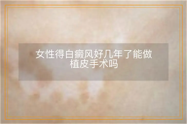女性得白癜风好几年了能做植皮手术吗