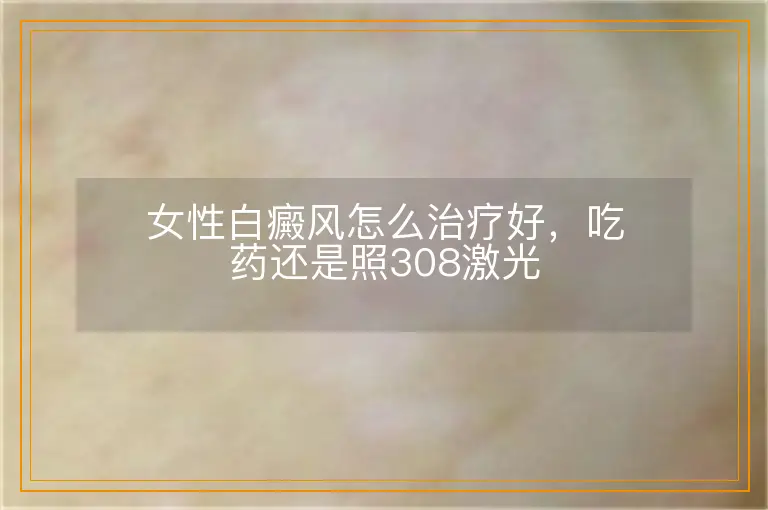 女性白癜风怎么治疗好，吃药还是照308激光