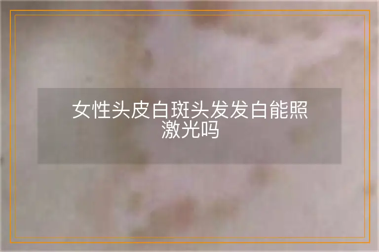 女性头皮白斑头发发白能照激光吗
