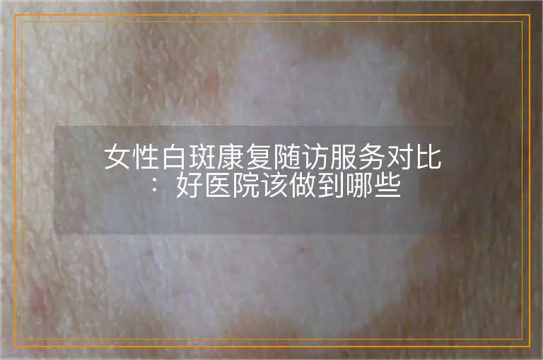 女性白斑康复随访服务对比：好医院该做到哪些