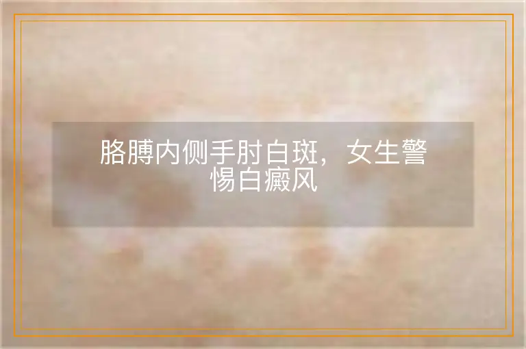 胳膊内侧手肘白斑，女生警惕白癜风