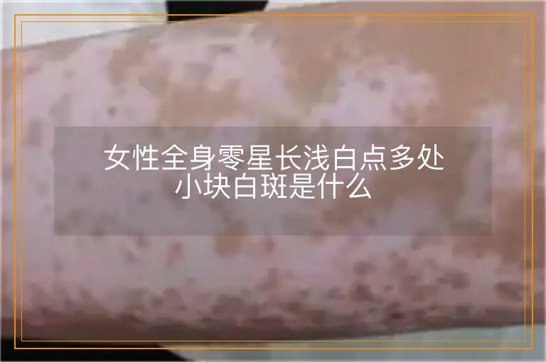 女性全身零星长浅白点多处小块白斑是什么