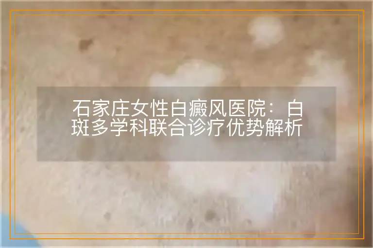 石家庄女性白癜风医院：白斑多学科联合诊疗优势解析