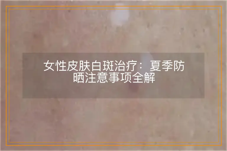 女性皮肤白斑治疗:夏季防晒注意事项全解